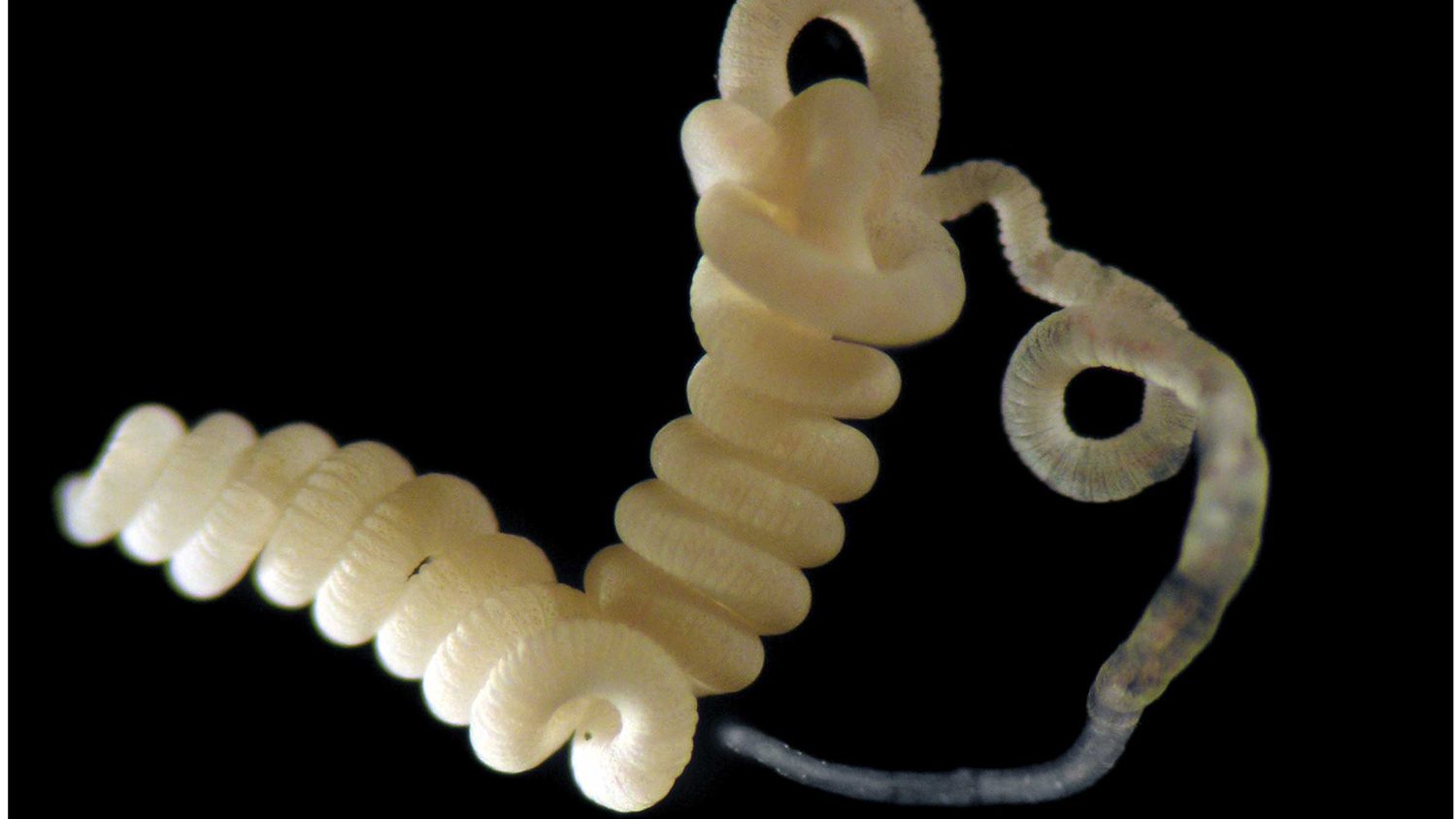 intestinal worm