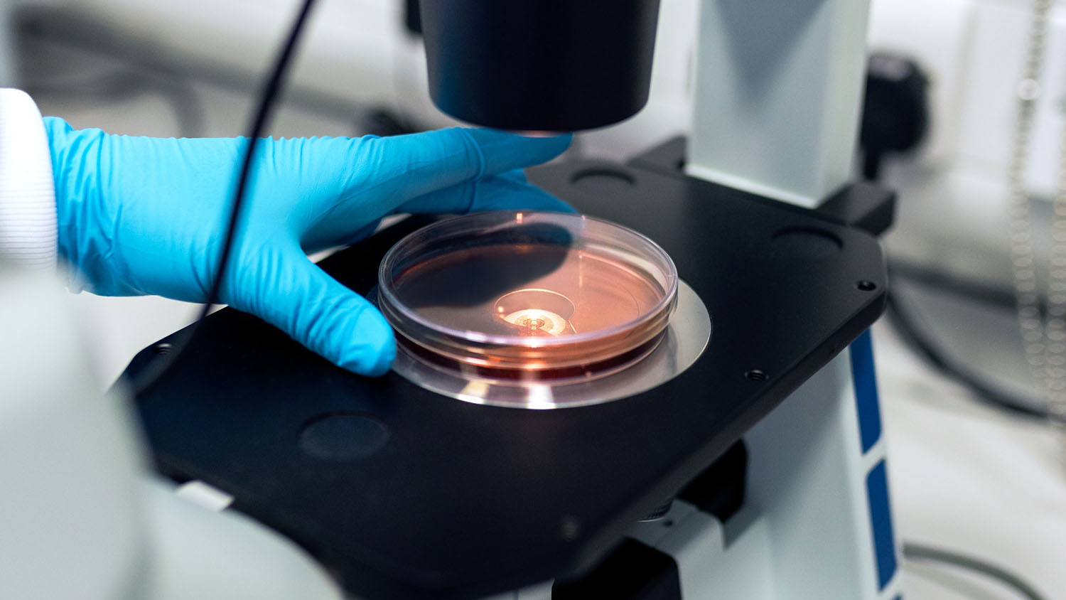 researcher places petri dish under microscope