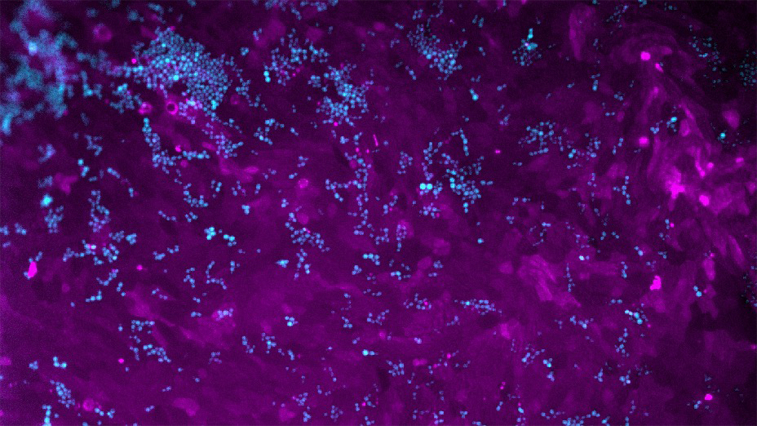 Yeast growing alongside human intestinal cells. Probiotic yeast (S. boulardii) are stained in blue, and primary human colon cells are stained in purple.